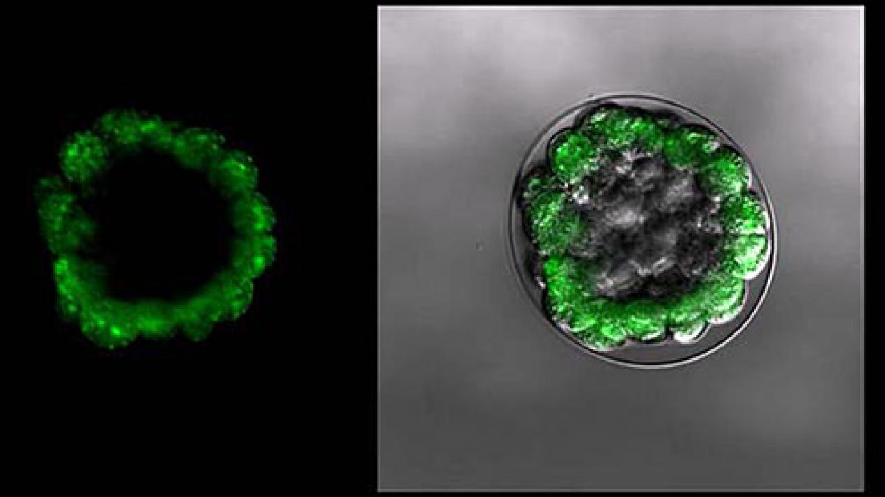 This urchin embryo was exposed to nontoxic nano-zinc oxide levels similar to those in sunscreens. The green dye shows that other toxins are retained when exposed to nanomaterials, and not pumped out by its natural defense mechanisms. (Photo UC Davis BML)